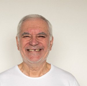 An older man with missing teeth