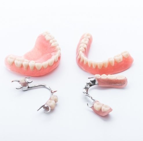 Four types of dentures