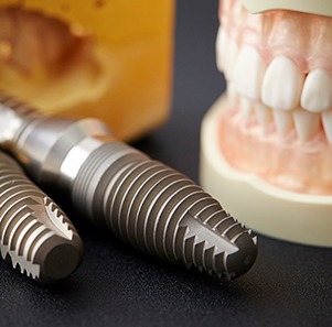 Dental implant surgery in Port Charlotte