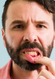 man showing inflamed gums 