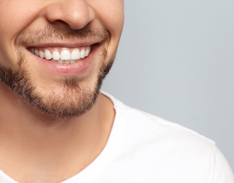 man closeup smile makeover in Port Charlotte  