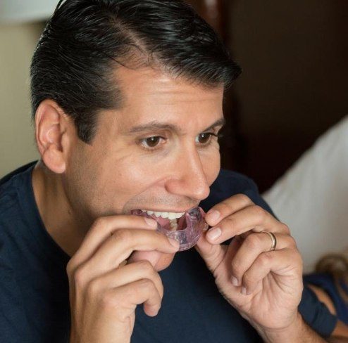 Man placing his nightguard for teeth grinding