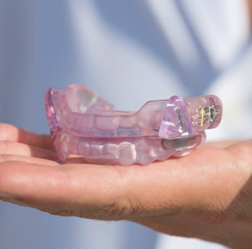Hand holding an oral appliance for sleep apnea therapy