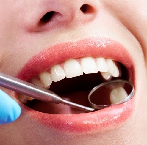 Dentist checking patient's smile after dental sealants