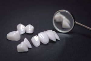 veneers laid out and ready to be attached to patient’s teeth