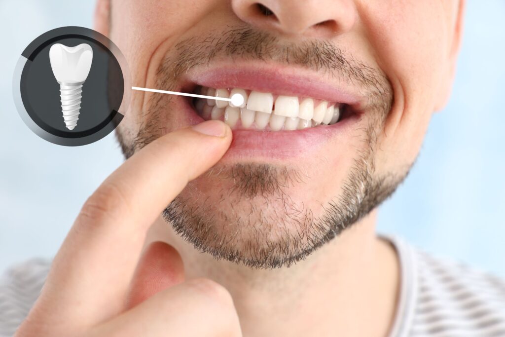 Nose-to-neck view of man pointing to tooth indicated as dental implant