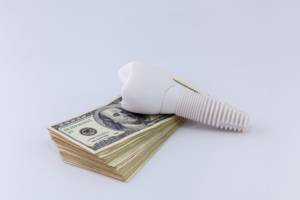 A dental implant sitting on a stack of bills