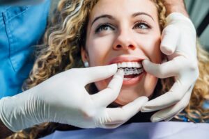 Dentist fitting clear aligner onto patient's teeth.