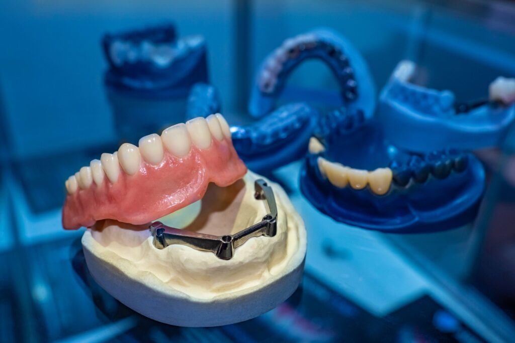 Lower arch of dentures resting on model base with dental implants with blue background